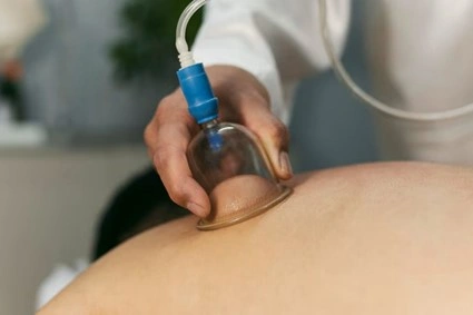Massagem relaxante com ventosaterapia