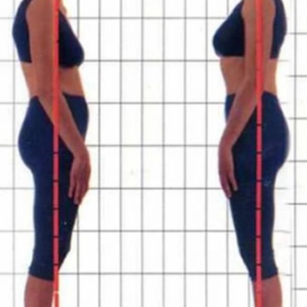 Avaliação Postural